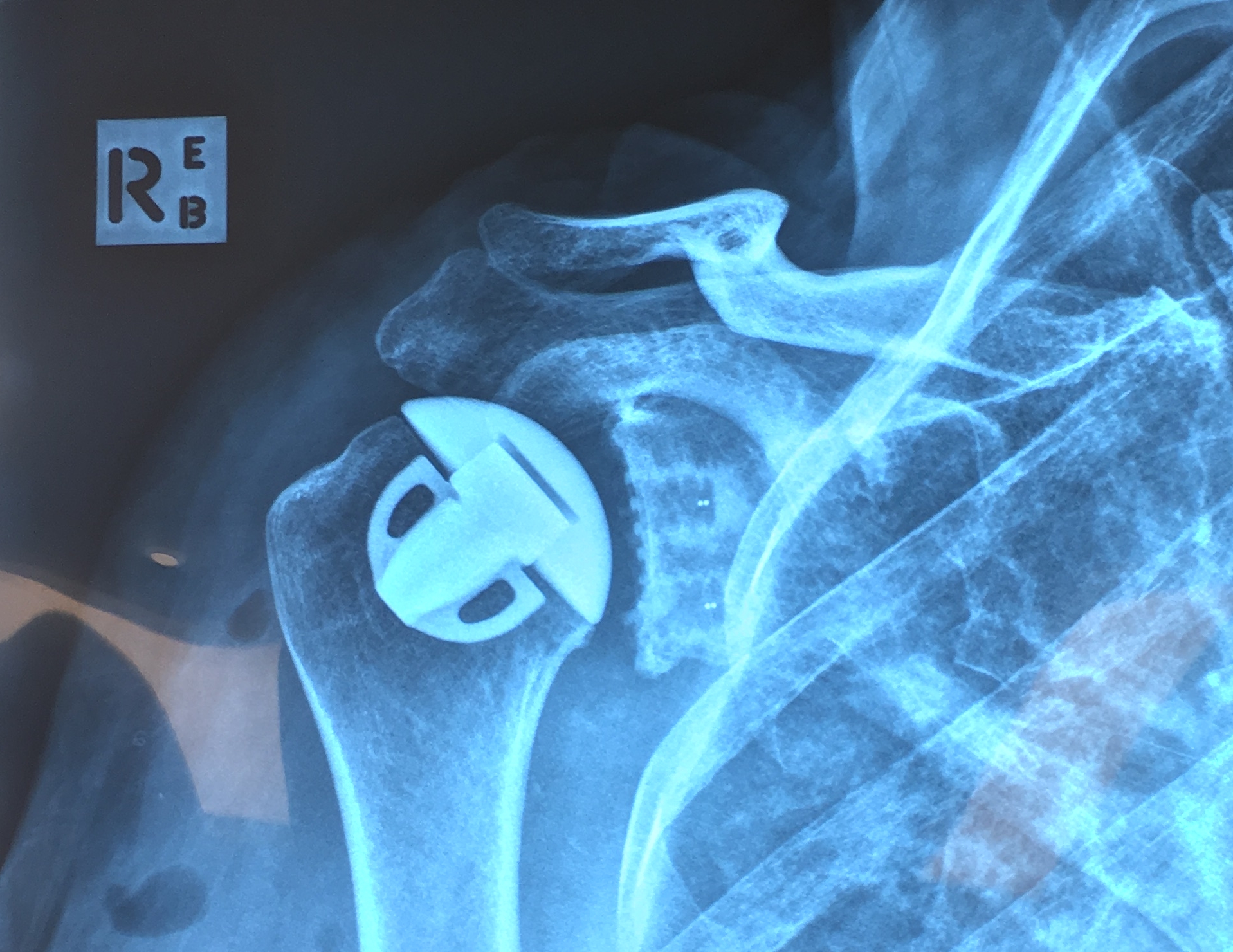 Dr Rishi Narasimhan Shoulder Knee And Trauma Surgeon