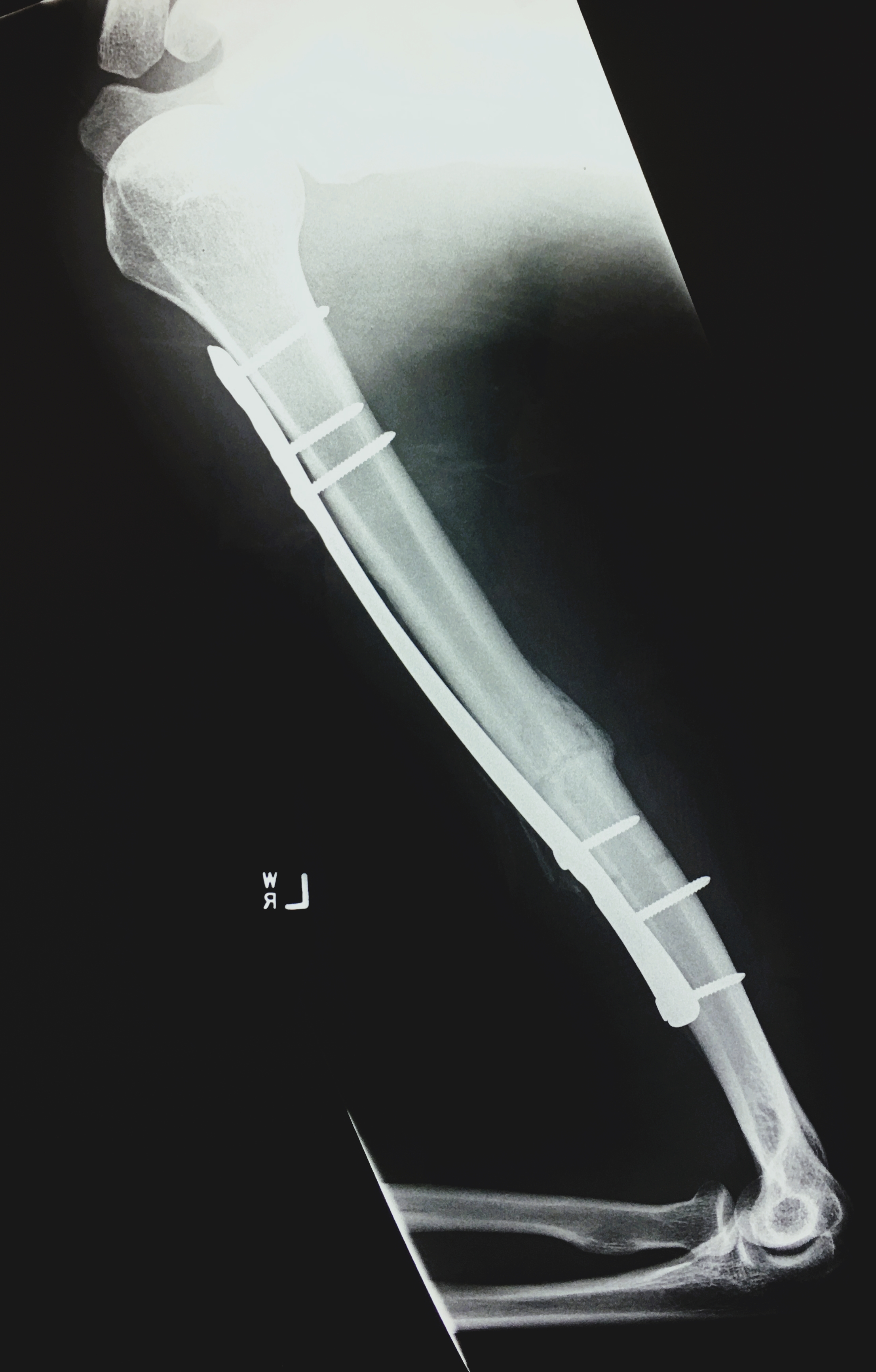 Dr Rishi Narasimhan Shoulder Knee And Trauma Surgeon